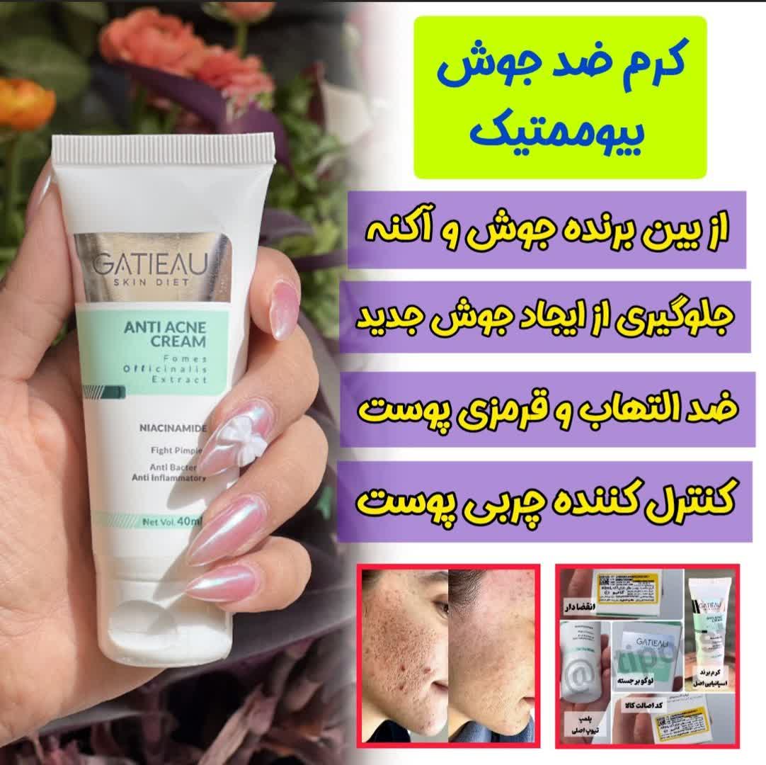 قویترین کرم ضد جوش و لک برند گاتیو ایتالیا 40 میل حجم
